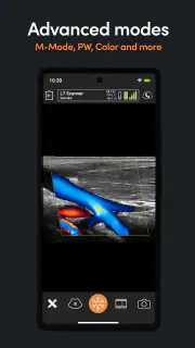 App de Ultrassom Clarius screenshot 4