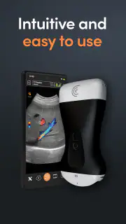 App de Ultrassom Clarius screenshot 6