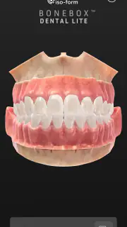 BoneBox™ - Dental Lite screenshot 1