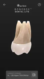 BoneBox™ - Dental Lite screenshot 2