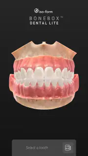 BoneBox™ - Dental Lite screenshot 8