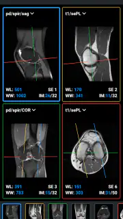 IDV - IMAIOS DICOM Viewer screenshot 3