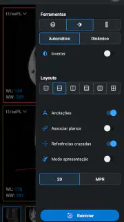 IDV - IMAIOS DICOM Viewer screenshot 4