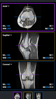 IDV - IMAIOS DICOM Viewer screenshot 5