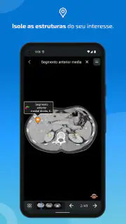 IMAIOS e-Anatomy screenshot 4