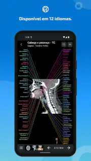 IMAIOS e-Anatomy screenshot 7