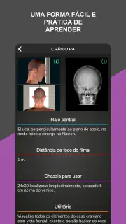 RX - Radiologia Posicionamento screenshot 3