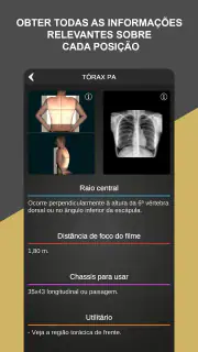 RX - Radiologia Posicionamento screenshot 4