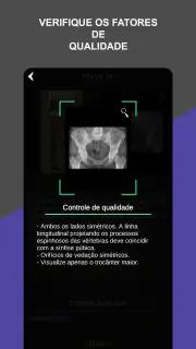 RX - Radiologia Posicionamento screenshot 6