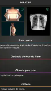 RX - Radiologia Posicionamento screenshot 8