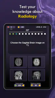 RX Trivia - Quiz de Radiologia screenshot 6