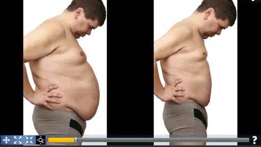Simulador de Cirurgia Plástica screenshot 3