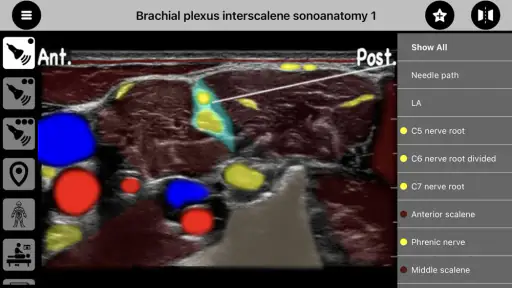 AnSo Anaesthesia Sonoanatomy screenshot 1