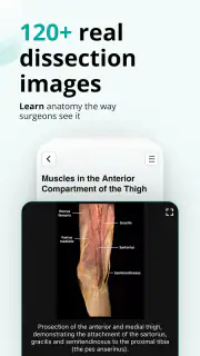 Teach Me Anatomy screenshot 4